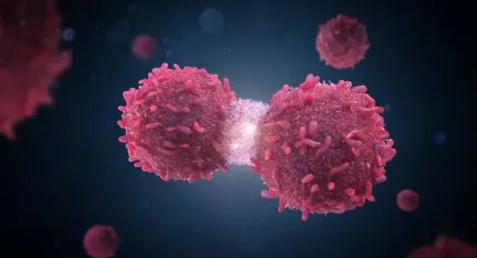 Kemosaturasyon ile kanser tedavisinde devrim: Karaciğerdeki tümörlere nokta atışı
