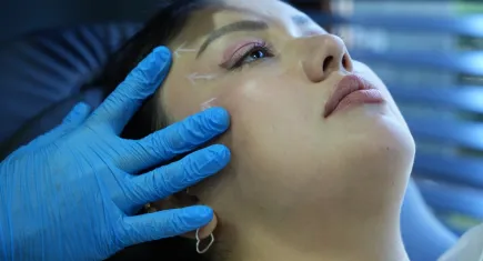 Estetikte yeni trend: ''Tilki göz'' ameliyatı