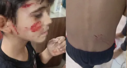 Gaziantep’te 5 sokak köpeği 8 yaşındaki çocuğa saldırdı
