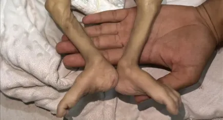 Filistin açlıkla mücadele ediyor: 6 kişi daha can verdi 